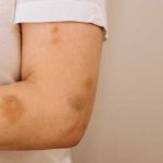 矫正“暴力矫正”