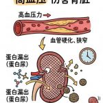 血压高，肾就“伤不起”